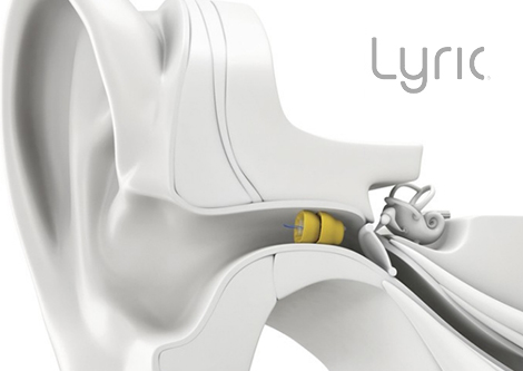 Illustration of a [Lyric Extended Wear hearing aid inside the ear canal]